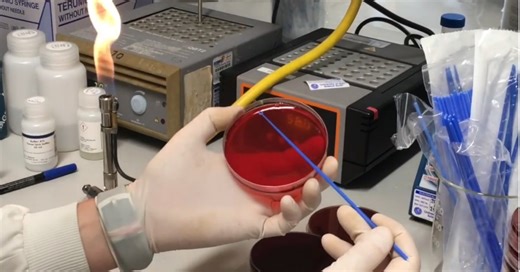 Everyone Has This Potentially Deadly Bacterium on Their Skin, Researchers Find