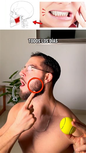 Pablo Iglesias | Pilates | Postura on Instagram: "Los automasajes en maseteros ayudan a reducir el exceso de tono muscular que mantiene la mandíbula en contracción involuntaria durante la noche. Al relajar estos músculos masticadores se reduce la presión mandibular. El bruxismo es multifactorial, pero la descarga muscular es clave. #bruxismo #yogafacial #gimnasiafacial #tinnitus #automasaje"