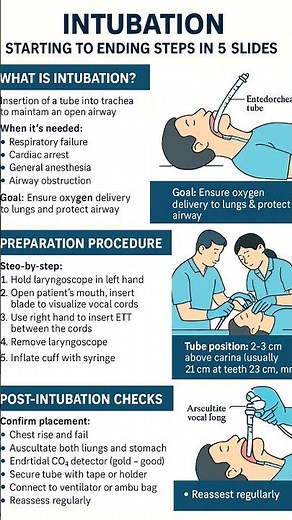 intubation procedure step by step