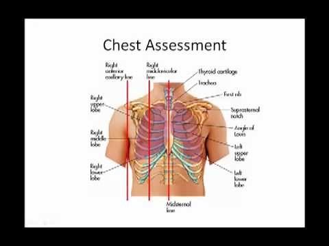 EMS Training | Chest Landmarks