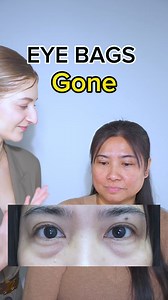 234K views · 1.7K reactions | How to reduce eye bags in 7 days #facefitnessexercise #antiagingtips #eyebags #eyebagshack #eyebagsremover #2933 | Pitfire Beauty | Facebook