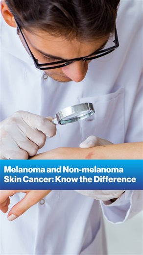 1.4K views · 12 reactions | Understanding the difference between melanoma and non-melanoma skin cancer is crucial for effective treatment. Melanoma can be more aggressive, while non-melanoma types are generally less so. Mount Sinai’s Dr. Nicholas Gulati shares how to spot the signs and consult with a board-certified dermatologist for an accurate diagnosis. #WeFindAWay #skincancerawareness #skincancer | The Mount Sinai Hospital | Facebook