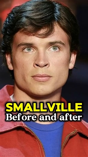 Smallville Cast: Their SHOCKING Transformation from 2001 to 2025! 🦸‍♂️🤯