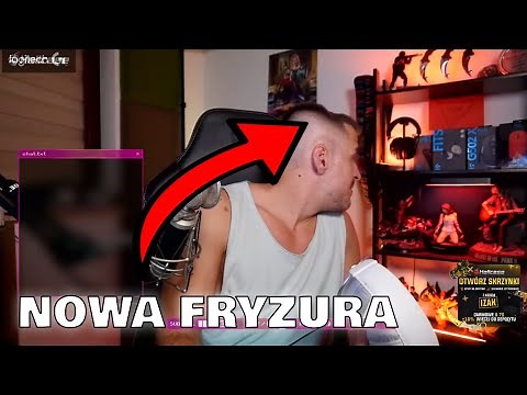 Izak pokazuje swoje wgniecenie na głowie 👀