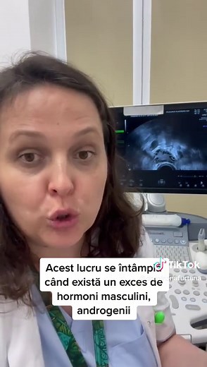 Cum arată ecografic ovarele polichistice?👩🏻‍⚕️ #doctorlife #pcos #women #ovulatie #sanatate #fertilitydoctor #doctorsoftiktok #health #gynecologist #sanatate #ginecolog #ovarepolichistice #pcosawareness