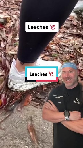 Understanding Leeches: Myths and Medical Uses