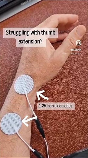 Electrode Placement for Thumb Extension