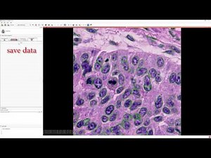 Slicer Pathology Tutorial