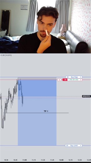 Trading ill is painful🥴 #fyp #forex #futures #daytrading #ict | forex trading