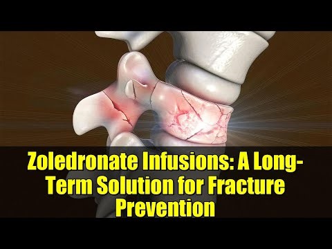 Zoledronate Infusions: A Long-Term Solution for Fracture Prevention