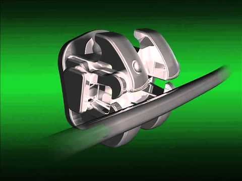 3M Smartclip Brackets