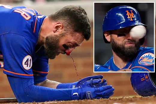 Horrific moment MLB star Kevin Pillar is smashed in face with 94mph fastball