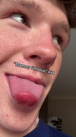 Discover Callum's Viral 'Mammy I'm Blue' Video