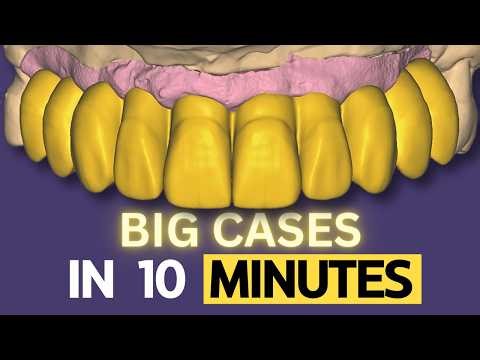 NEW TRICK = SAVE TIME & MAKE You RICH. + INTAGLIO EXPLAINED (In Detail) EXOCAD 2025