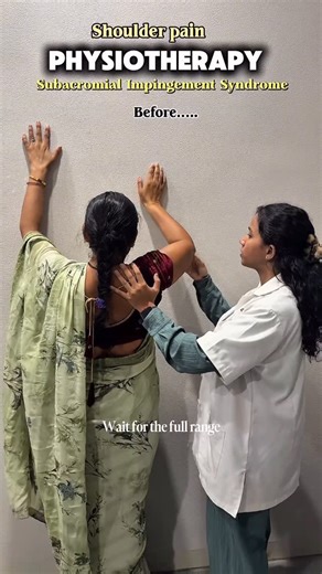 Satyam Physiotherapy on Instagram: "Subacromial Impingement Syndrome (Before ➝ After) Before: Painful arc, night pain, limited overhead movements 😣 After: Improved ROM, reduced pain & confident shoulder movements 💪✨ 👉🏻Subacromial Impingement Syndrome can limit daily activities, but with proper assessment, targeted exercises, manual therapy & consistency, recovery is absolutely possible. ✅This transformation is a result of patient commitment + evidence based physiotherapy 👏 Recovery is not m