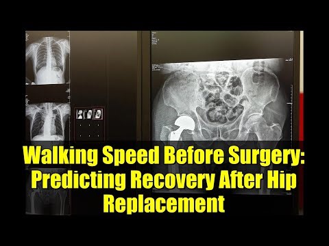 Walking Speed Before Surgery: Predicting Recovery After Hip Replacement