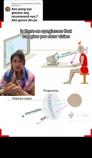 Replying to @cynthiadelacruz540 standard single vision lenses only provide the grade that is needed to correct blurred vision either at near or at far and relies on your eye’s focusing muscles to maintain clear vision in all distances. However, when you’re in your 40s or in your senior years, your focusing muscles aren’t able to adjust well and maintian clear vision. This is called presbyopia and it is age-related. Hence, if you have presbyopia and you are using a minus lens to correct myopia or
