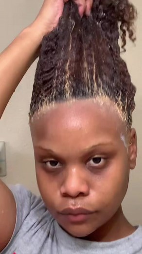 Attempting the Scandinavian Hairline on Curly Hair