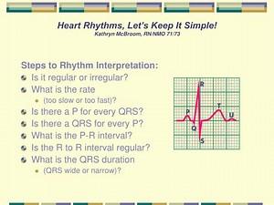 Heart Rhythms, Let’s Keep It Simple! Kathryn McBroom, RN/NMO 71/73 - SlideServe