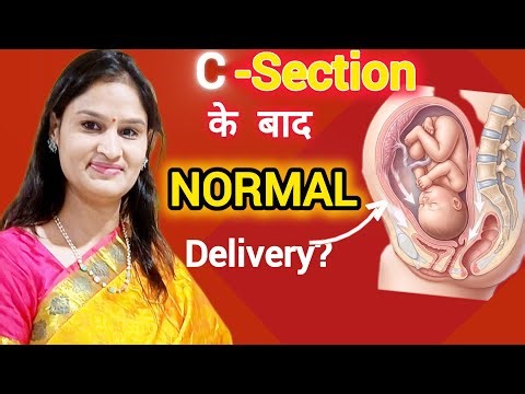 C-Section के बाद Normal delivery Possible? | VBAC Explained