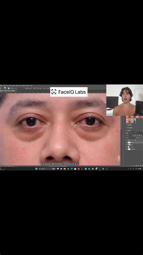 Understanding Upper Eyelid Contours in Face Morphing