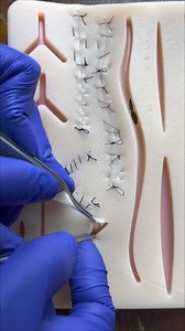 Continuous sutures comparison: running buried dermal suture | Dermhacks