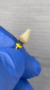 4.4K views · 147 reactions | Custom Zirconia abutment #zircad #prime #ivoclar | Yuki Momma | Facebook