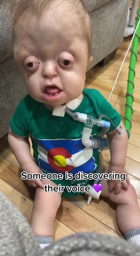 Literal music to my ears 💜 #risewithraedyn #trachbaby💕 #pfeiffersyndrome