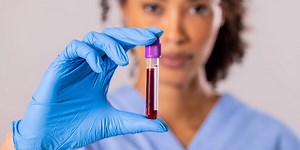 Pay Attention to Your PSA