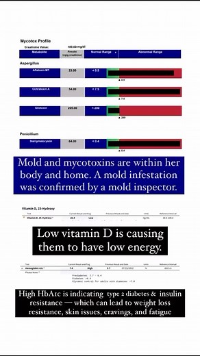our labs aren’t normal. Your doctor just didn’t check in the right places. You deserve more. That’s why I use functional tests like the ones in my reel — they changed the game. You need a practitioner who truly listens to get healthy. Treat the person, not the symptoms. 🙏 DM me “GET STARTED” if you’re interesting in working with my clinic 1-on-1! ☺️ 🔹1st slide: Mycotoxin Panel by Mosaic Labs blood work 🔹2nd slide: Hair Tissue Mineral (HTMA) Analysis by Trace Elements 🔹3rd Slide: Organic Acid