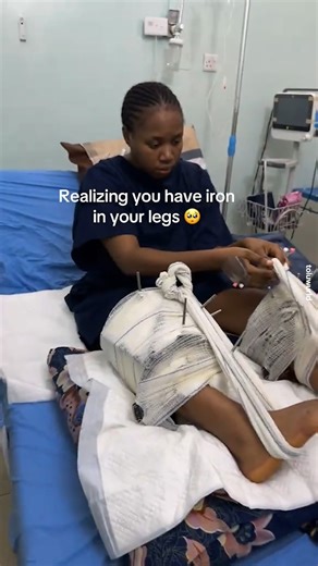 What’s it really like to have bowed legs?👀 🎥:toluwurld | Unwritten Beauty