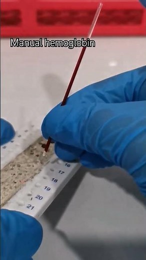 manual hemoglobin using capillary tube