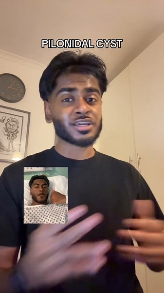 Understanding Pilonidal Cysts and Their Pain Management