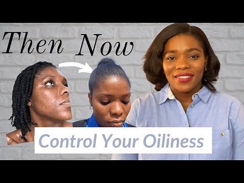 7 Skincare Tips for Oily Skin | How to control Sebum production on the face - Dr. Janet