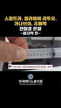 What's the difference between Sculptra and GanaV particles? #Sculptra #GanaV #shorts