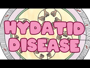 Hydatid disease (ECHINOCOCCOSIS)| Life Cycle | Pathogenesis | Lab diagnosis | liver microbiology