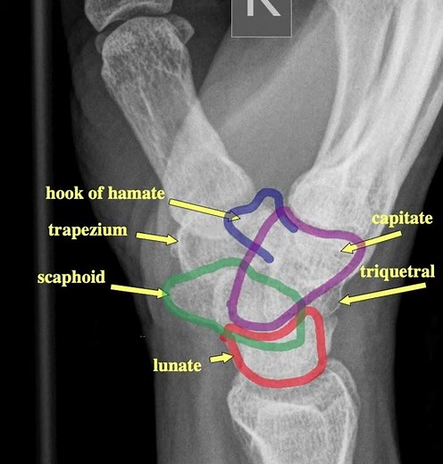 Wrist lateral radiograph view