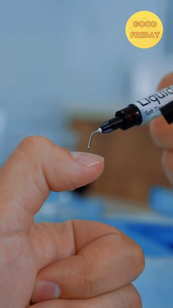Usos de la resina fluida dental