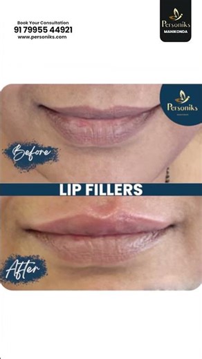 Perfect lips begin with expert care 💋