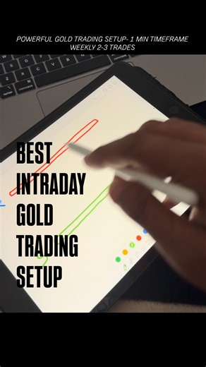 Dr Deepanshu Aggarwal | Trader | Surgeon on Instagram: "Backtest it and forwardtest it… Save Follow @tradewithsurgeon"