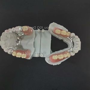 [Hot Item] Customized Removable Dentures with Metal Framework (co, cr alloy or titanium) Support on Acrylic Teeth