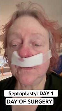 Septoplasty surgery: DAY 1