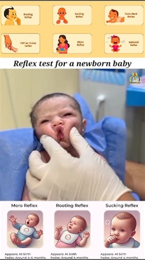 Reflex test for newborn baby #reflexes #newborn #newbornbaby #viral #nursingking