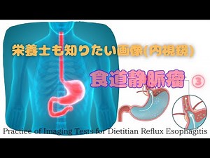 #112③【Images that even dietitians want to know (Endoscopy) - Reflux Esophagitis】Practice of Imagi...