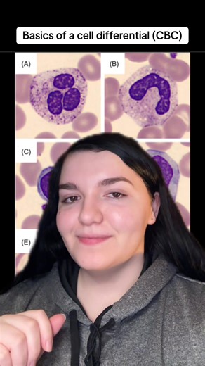 Allison MLS (ASCP) ✨ (@allison_mls_ascp)’s videos with original sound - Allison MLS (ASCP) ✨