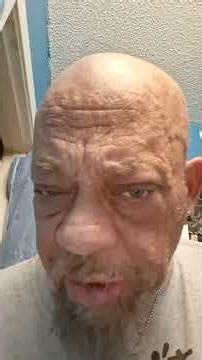 After using Magic Razorless Shave cream. (The outcome. )