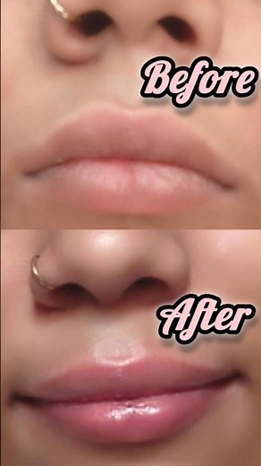 Get Soft Pink Lips👄 in Just 10 Minutes✨#GlowUp #viral #ytshorts #skincare #explore #Fyp #foryou #diy