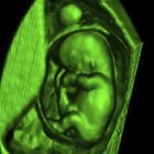 The Effects of X-Rays in the First Month of Pregnancy