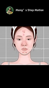 Super Decompression! Popping Huge Blackheads #asmr #解壓 #animation | Meng's Stop Motion