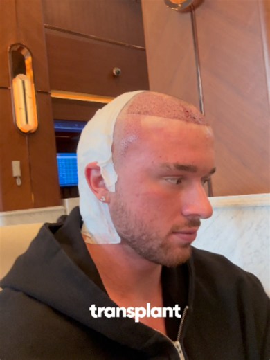 Tired of Losing Hair? You're Not Alone. 🧑‍🦲 Meet the breakthrough in hair regrowth – AlphaInfuse Hair Regrowth System. No side effects, no harsh chemicals, just pure science to restore your hair back. Formulated for men like you, battling hair loss. Our unique blend of Licorice Root Extract, Ginger Root, Black Sesame, and Citric Acid tackles the root cause of hair thinning. With micro-infusion technology, the ingredients penetrate deep into the roots for maximum absorption and faster regrowth.